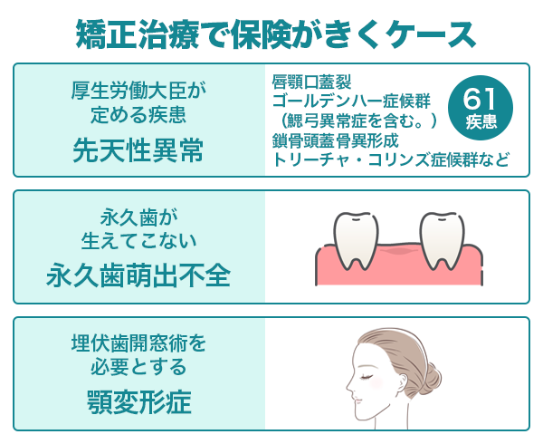 歯科矯正で保険が適用されるケース