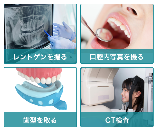 歯の検査の項目